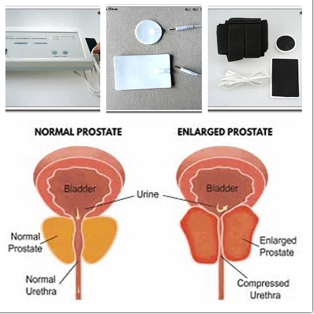 Potente Masajeador de Próstata - Therapy Health And Wellness reseña y precio